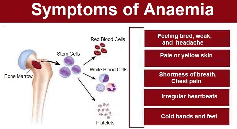 Anemia Symptoms Causes And Treatments Of Anemia Centralviral 4438