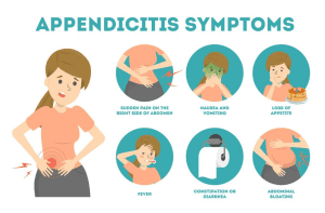 Appendicitis-Symptoms