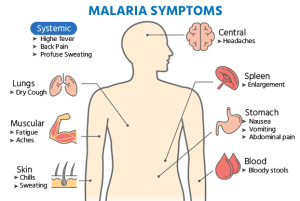 malaria symptoms