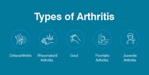 Types of Arthritis